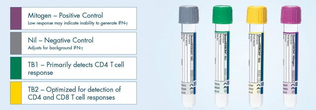 Квантфивероновй тест (QuantiFERON-ТВ Gold)
