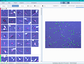 Спермоанализатор на базе ПО для компьютерного анализа эякулята, Аргус-CASA