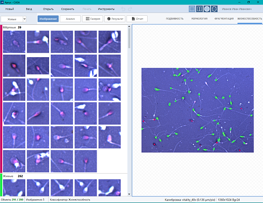 Спермоанализатор на базе ПО для компьютерного анализа эякулята, Аргус-CASA, АргусСофт Фото 4