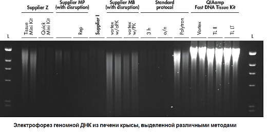 Набор для выделения ДНК из тканей QIAamp Fast DNA Tissue Kit, Qiagen Фото 2