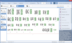 ПО для автоматического анализа хромосом, кариотипирования, Аргус-Karyo