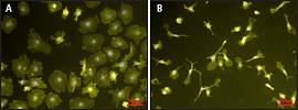 Липополисахарид из E.coli/Lipopolysaccharides from E.coli, 0111:B