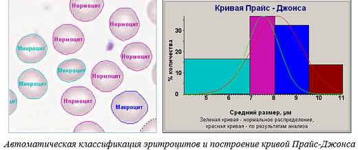 ПО для анализа крови, лейкоцитарная формула, эритроцитометрия, подсчет тромбоцитов, Аргус-Blood, АргусСофт Фото 3