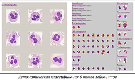 ПО для анализа крови, лейкоцитарная формула, эритроцитометрия, подсчет тромбоцитов, Аргус-Blood