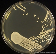 Агар декстрозный сабуро, sabouraud Dextrose Agar